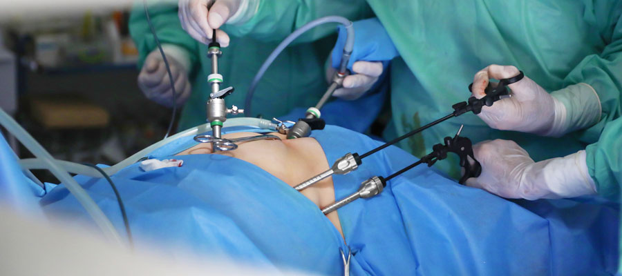 Advanced Laparoscopy & General Surgery