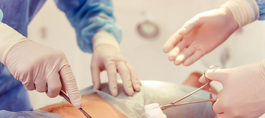 Appendectomy