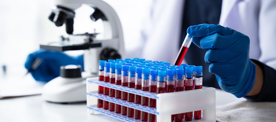 Blood Tests