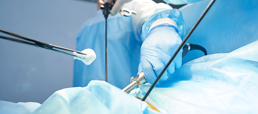 During laparoscopic surgery